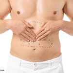 کلینیک جراحی شکم ابدومینوپلاستی